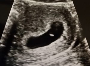 Ultrasound picture of Mama Rissa's first baby who was miscarried.