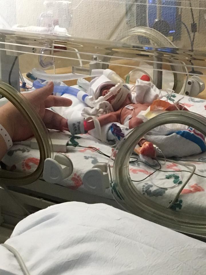 Katie's preemie daughter in an incubator.