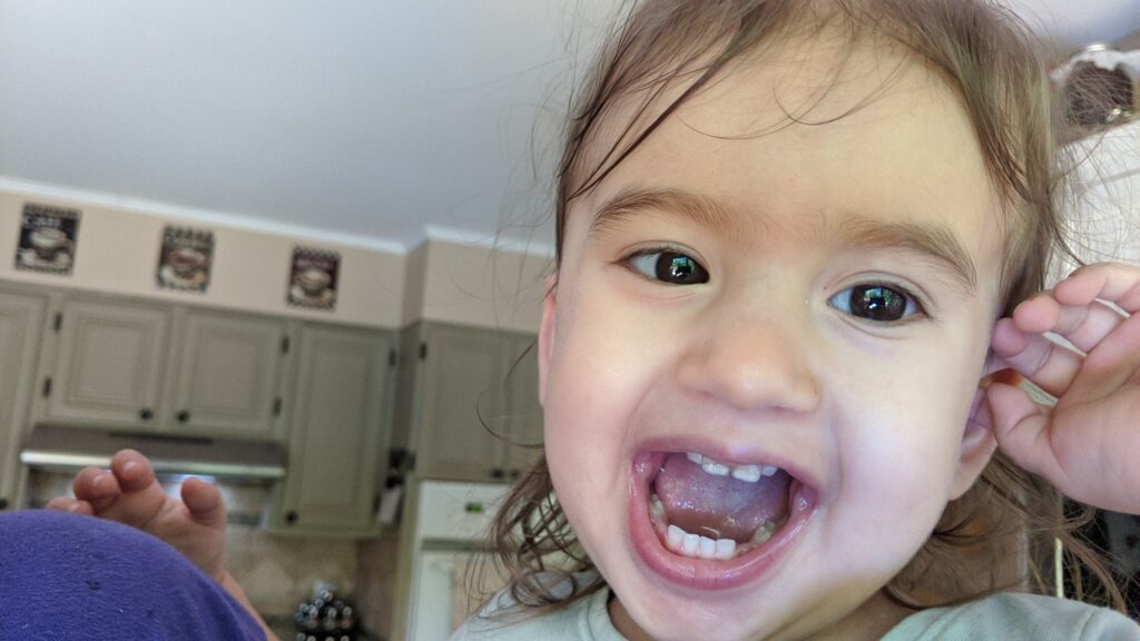 Mama Rissa's toddler showing off her not-so-pearly whites.