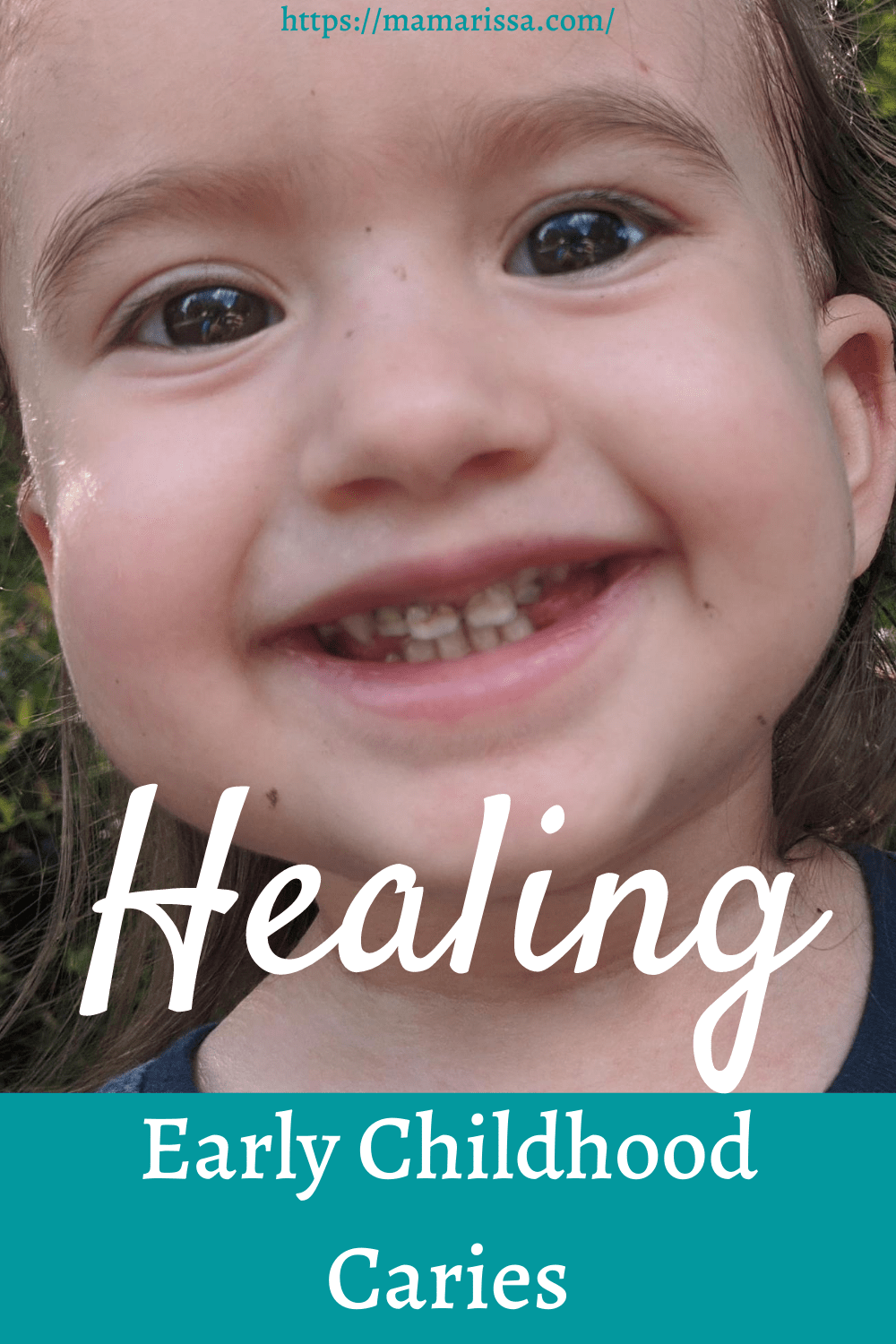 Healing Early Childhood Caries