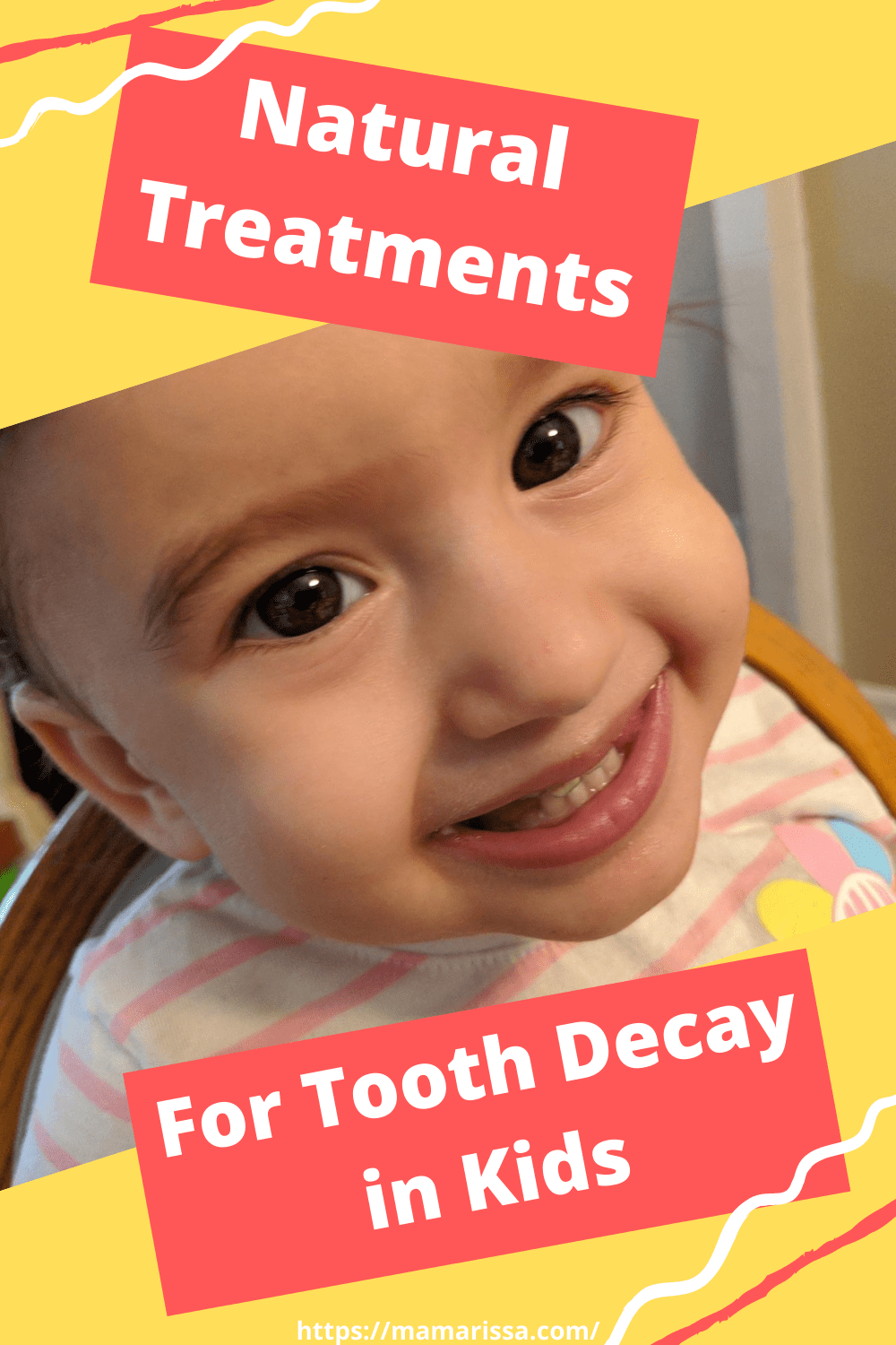 Natural Treatments for Tooth Decay in Kids