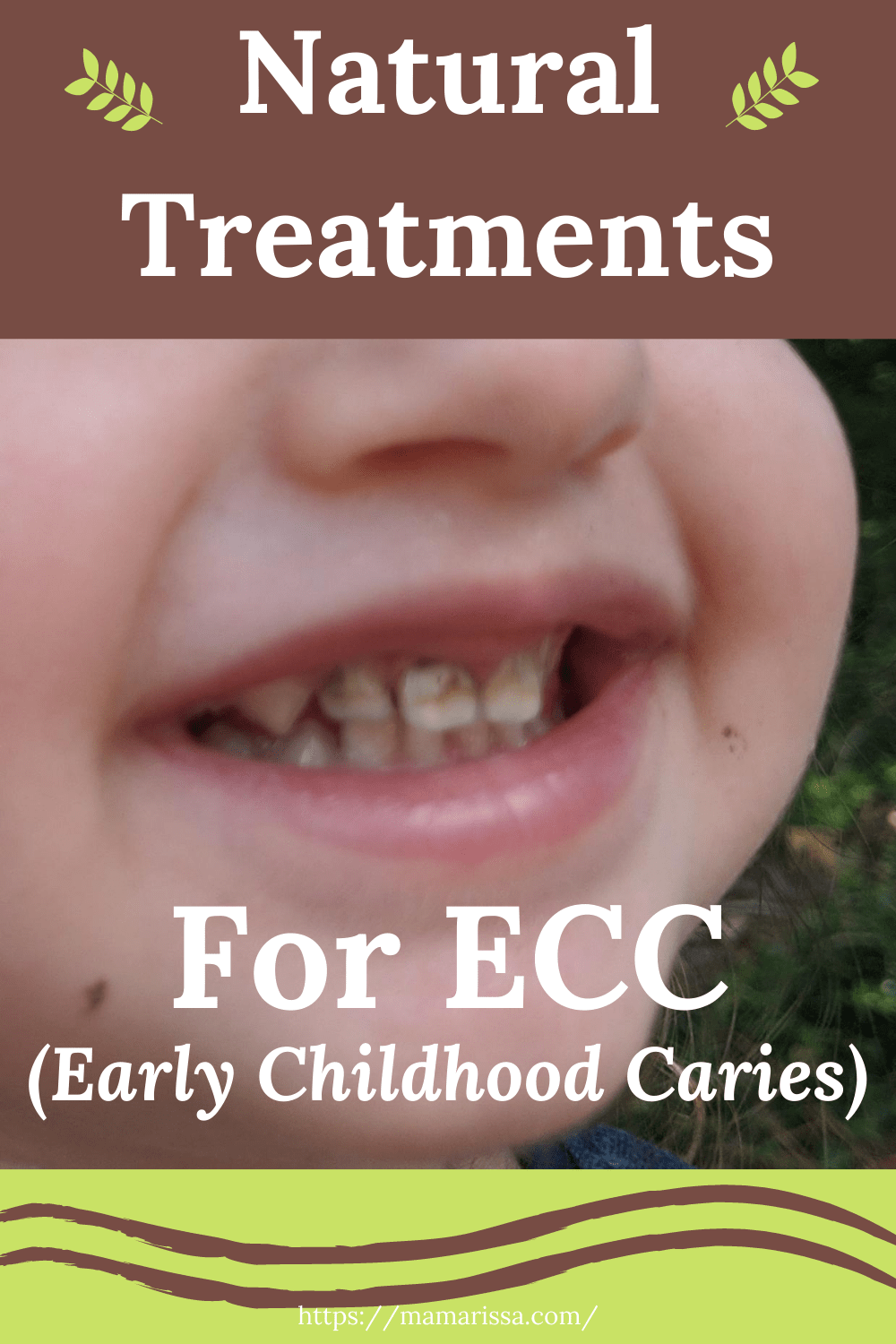 Natural Treatments for ECC (Early Childhood Caries)