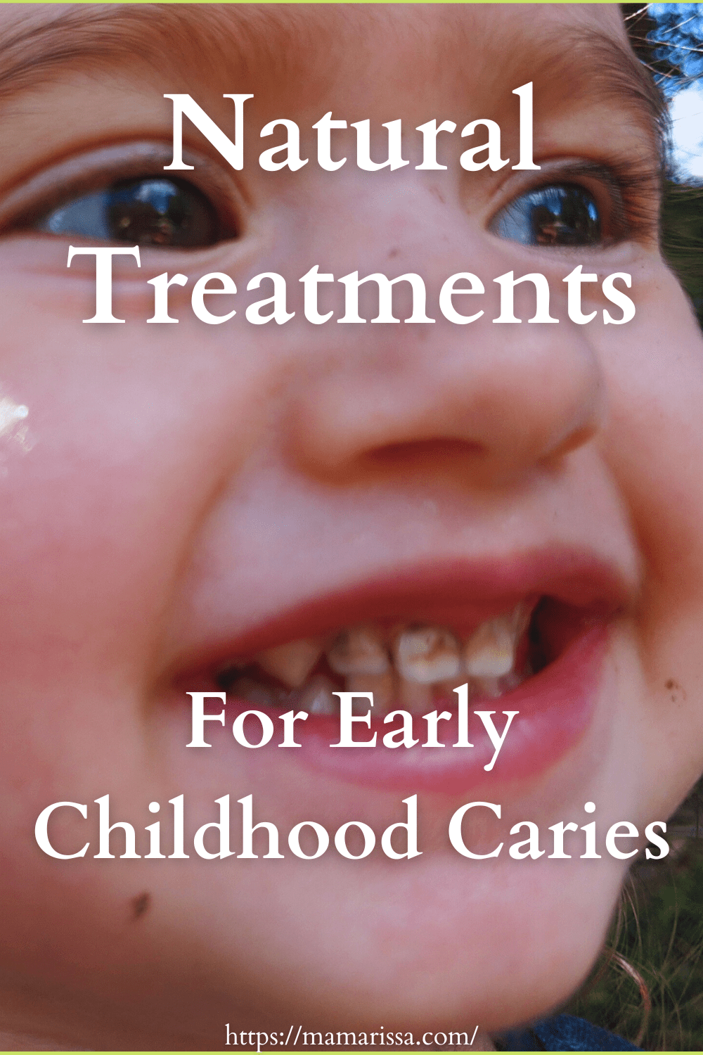 Natural Treatments for ECC (Early Childhood Cares)