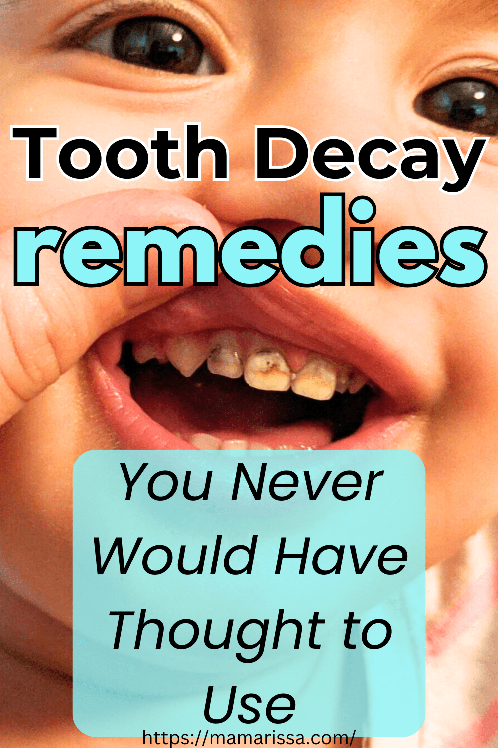 Tooth Decay Remedies You Never Would Have Thought to Use