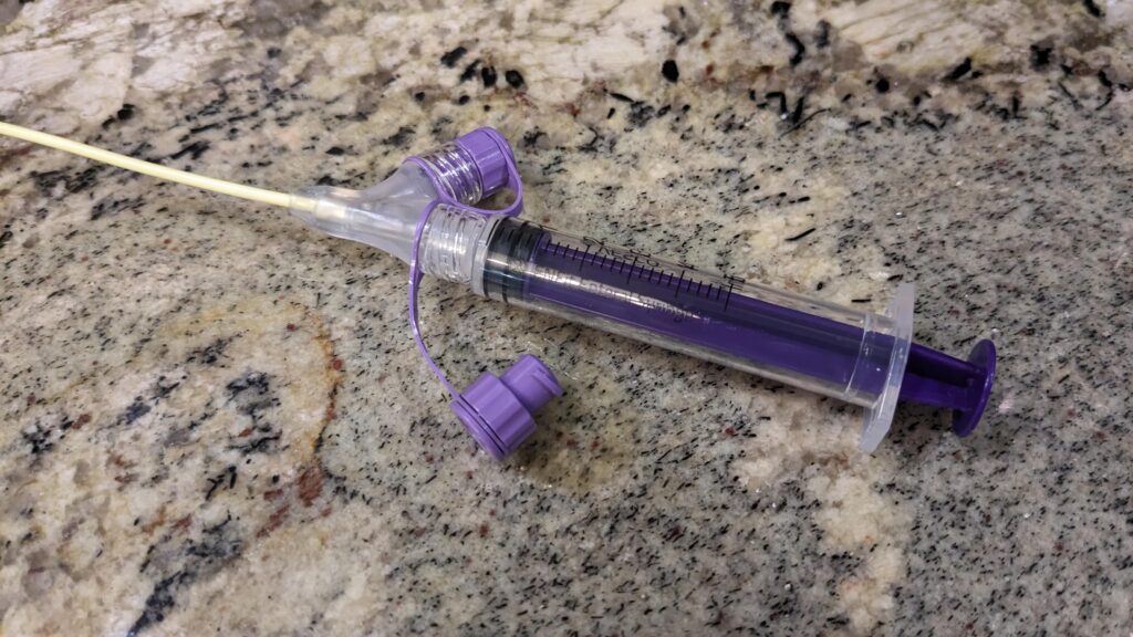 Syringe screwed onto Baby NG tube port