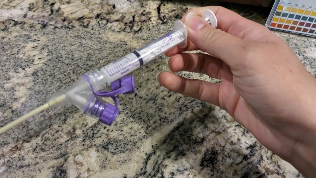 Syringe with gastric contents from baby NG tube