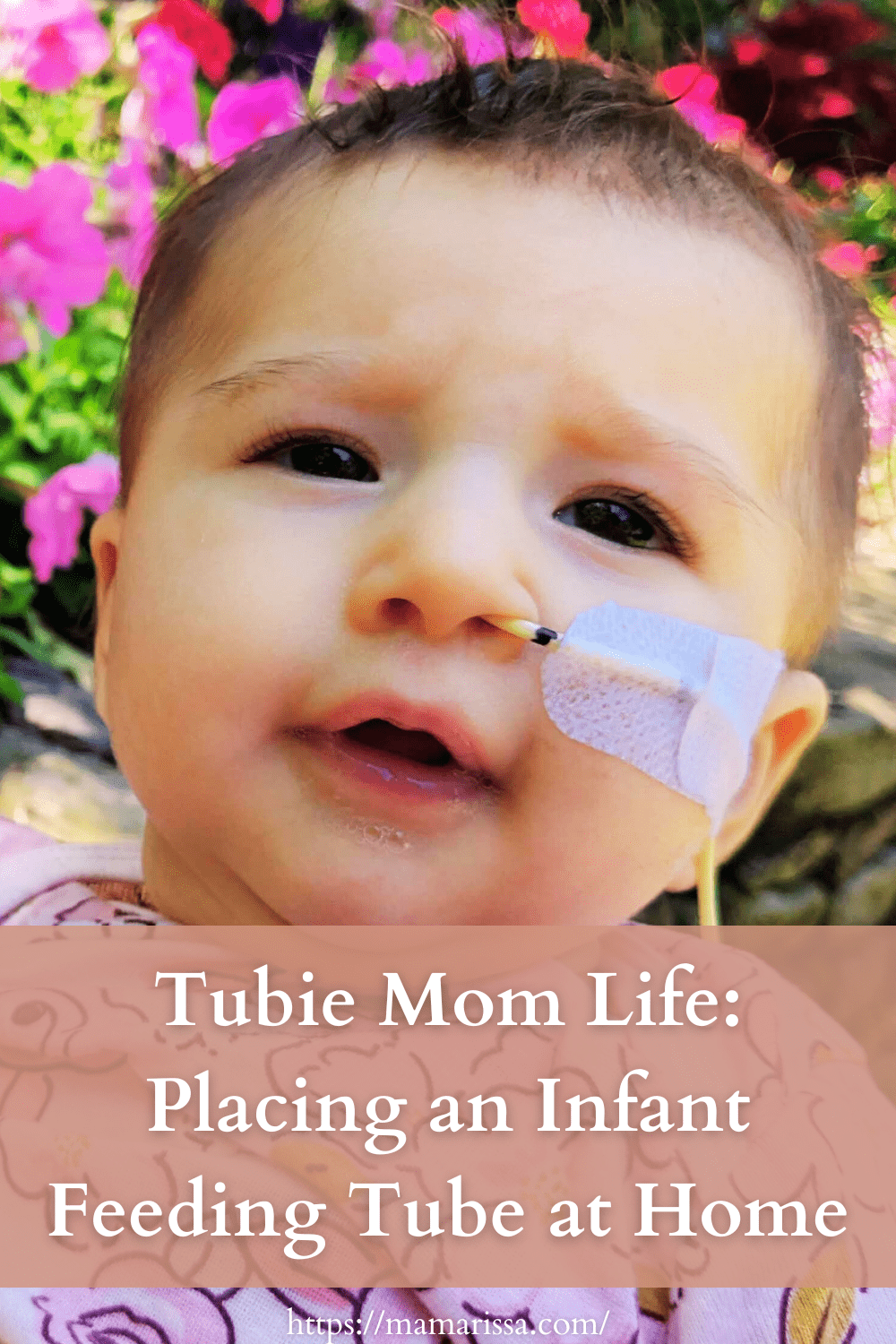 Tubie Mom Life: 
Placing and Infant Feeding Tube at Home