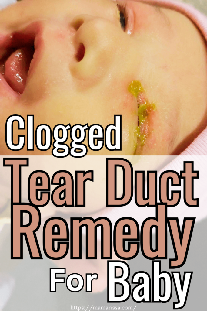 Clogged Tear Duct Remedy for Baby