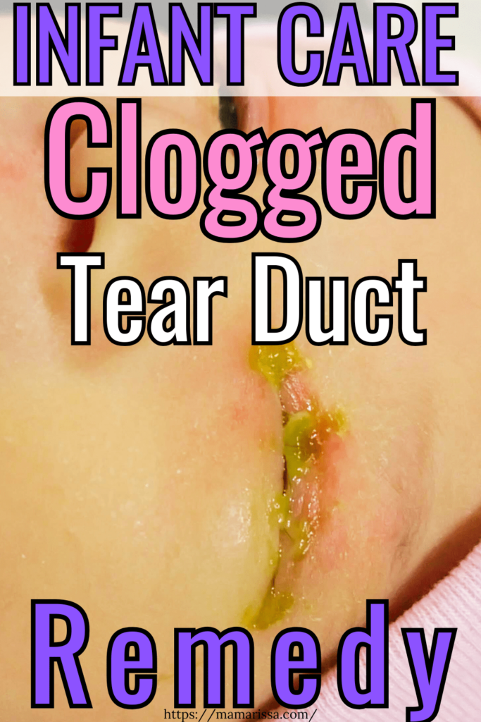 Infant Care

Clogged Tear Duct Remedy