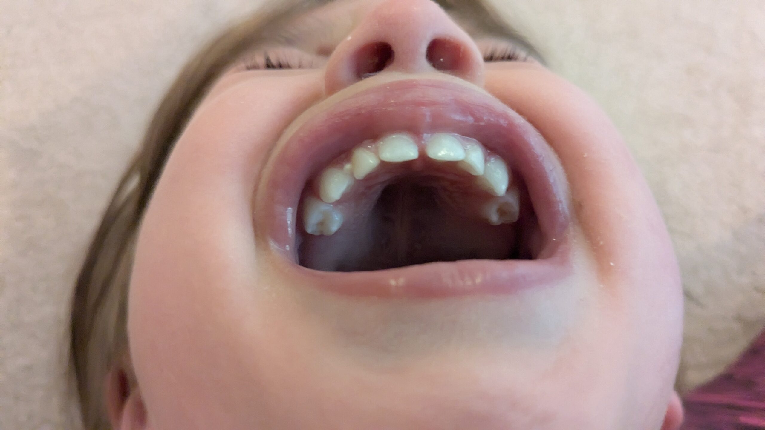 Image of Crying Child