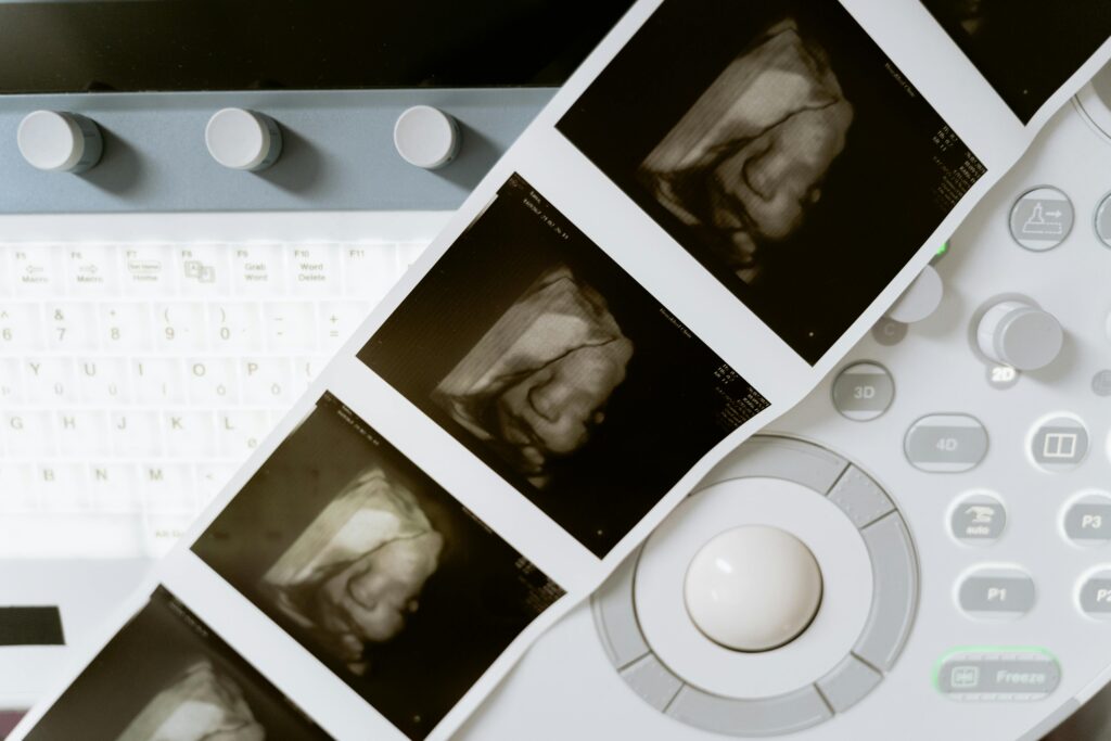 Baby Ultrasound Pictures